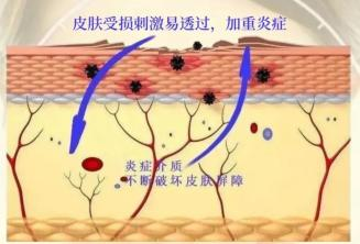 PDRN,恒昱PDRN,PDRN原研专利,PDRN原料 ,PDRN生产,PDRN护肤,三文鱼PDRN,HYPDRN