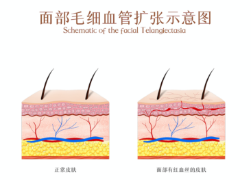 PDRN,恒昱PDRN,PDRN原研专利,PDRN原料 ,PDRN生产,PDRN护肤,三文鱼PDRN,HYPDRN