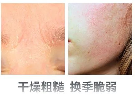 PDRN,恒昱PDRN,PDRN原研专利,PDRN原料 ,PDRN生产,PDRN护肤,三文鱼PDRN,HYPDRN,PDRN化妆品
